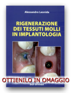 Rigenerazione dei tessuti molli in implantologia di A. Leonida ©EDI-ERMES 2013